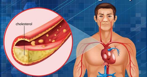 Memerangi Kolesterol Tinggi dalam Penuaan yang Sehat